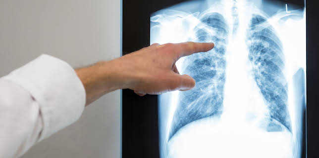 11:40: aktiv und gesund | SR Fernsehen | 3/23 2026