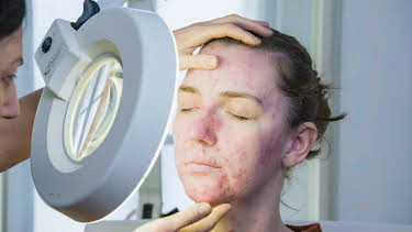 14:25: The Bad Skin Clinic (S2 E3) (S2) | TLC | 5/14 2026