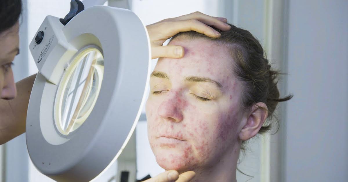 2/2 15:25 | The Bad Skin Clinic på TLC