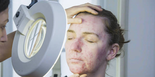 14:25: The Bad Skin Clinic (S2 E3) (S2) | TLC | 2/2 2026