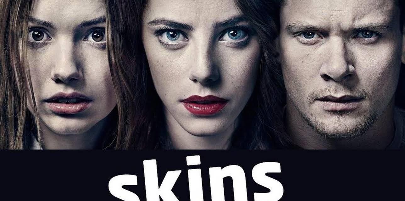 Skins UK