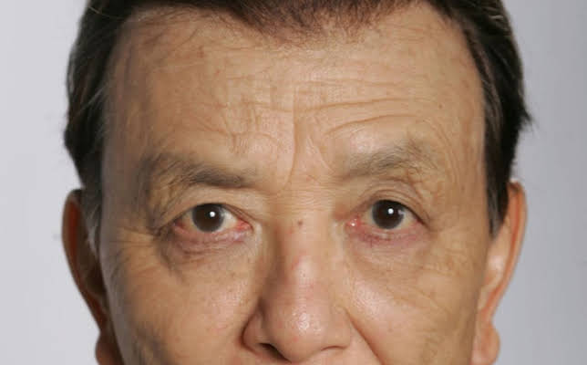 James Hong