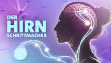 Der Hirnschrittmacher