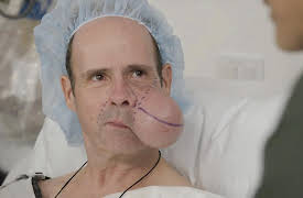 About Face: Tumorous Maximous