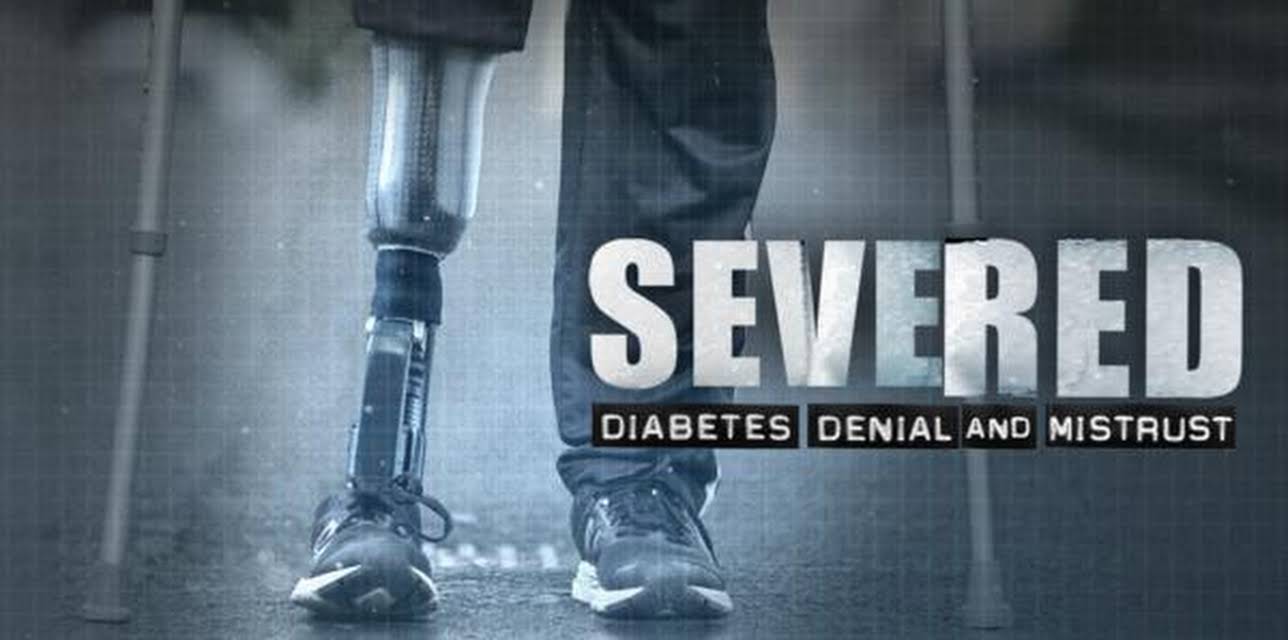 Severed: Diabetes Denial and Mistrust 