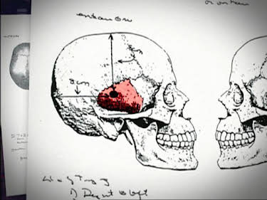 04:35: Medical Detectives - Geheimnisse der Gerichtsmedizin | VOX | 4/25 2026