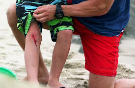 Monsters Inside Me: Something Living in my Knee