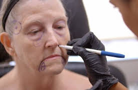 Skin Decision: Before and After: Fixing My Face