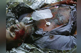 Sin City ER Season 1: Crash, Smash & Flash