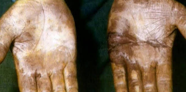 04:55: Medical Detectives - Geheimnisse der Gerichtsmedizin | VOX | 1/26 2026