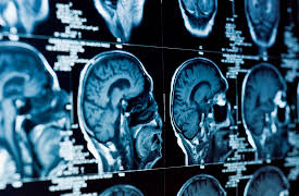 How We Learn: Integrating Different Domains of Learning