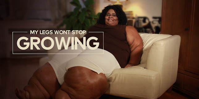 My Legs Won't Stop Growing